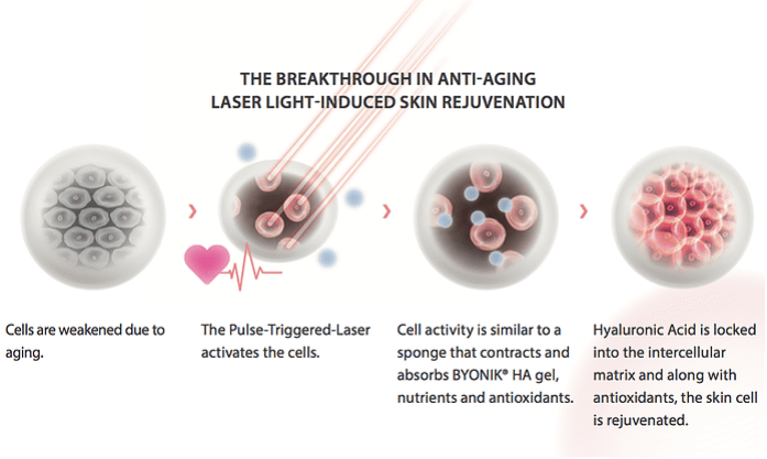 anti-aging laser light-induced skin rejuvenation