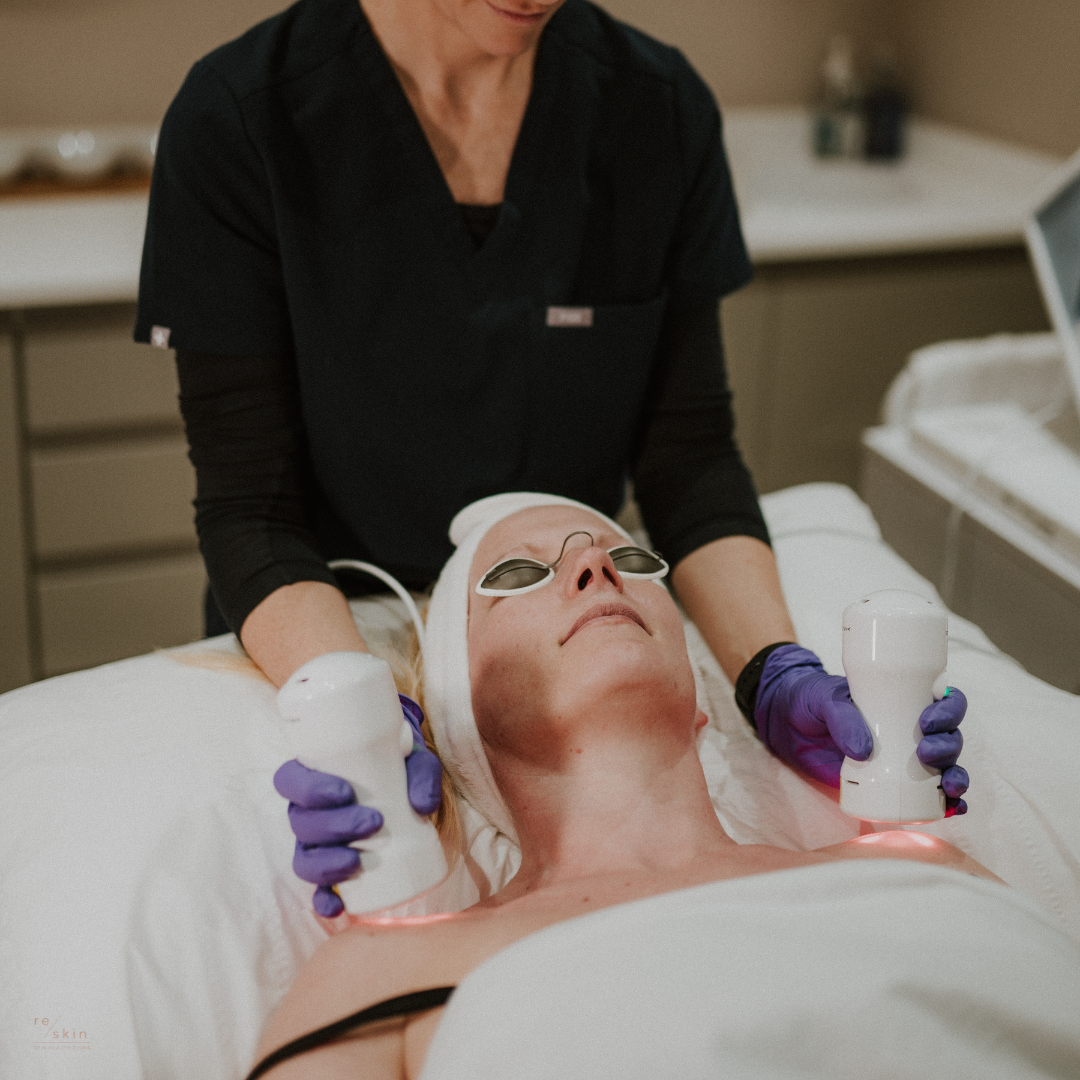 Byonik treatments skin repair clinic Sheffield